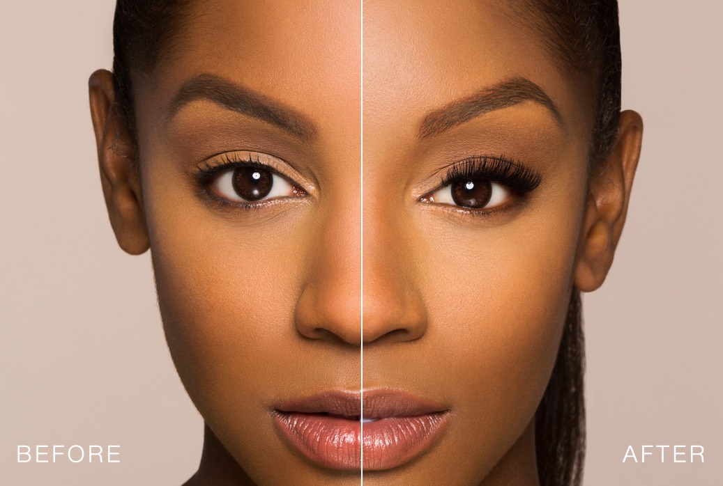 Volume Delineado - Antes e Depois